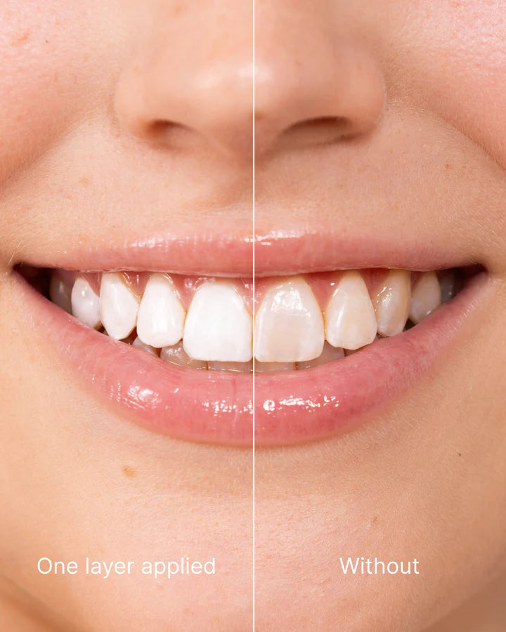 W.O.W Teeth Whitening - Instant White Teeth